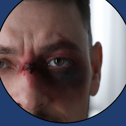 Facial trauma care