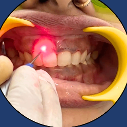 LASER Dentistry